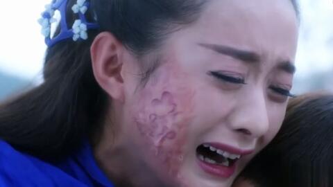 毁容明星,明星逆境逆袭之路